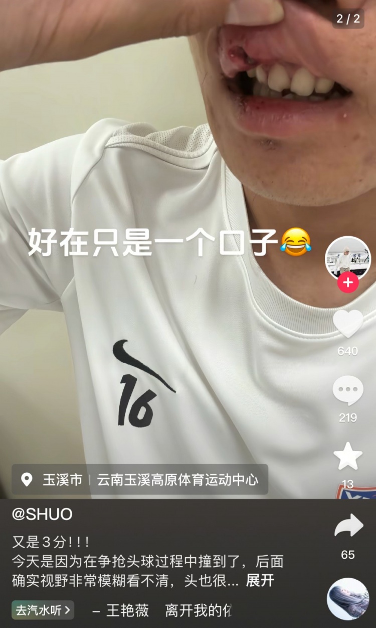 玉昆后卫晒受伤照:提前换下因争头球撞到了 视野模糊看不清&头晕